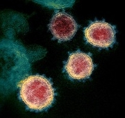 This transmission electron microscope image shows SARS-CoV-2—also known as 2019-nCoV, the virus that causes COVID-19—isolated from a patient in the U.S. Virus particles are shown emerging from the surface of cells cultured in the lab. The spikes on the outer edge of the virus particles give coronaviruses their name, crown-like. Credit: NIAID-RML
https://www.flickr.com/photos/niaid/49534865371/